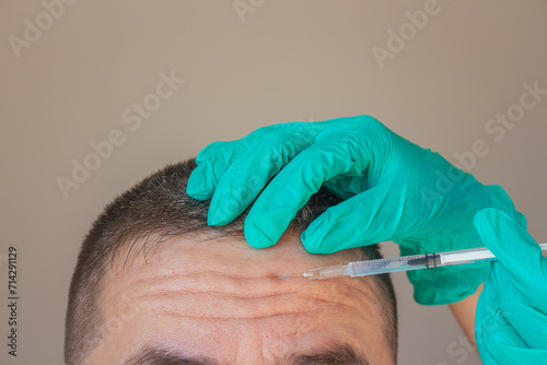 Fotografie A cosmetologist in green gloves uses a syringe to inject a young man to eliminate horizontal wrinkles on his forehead