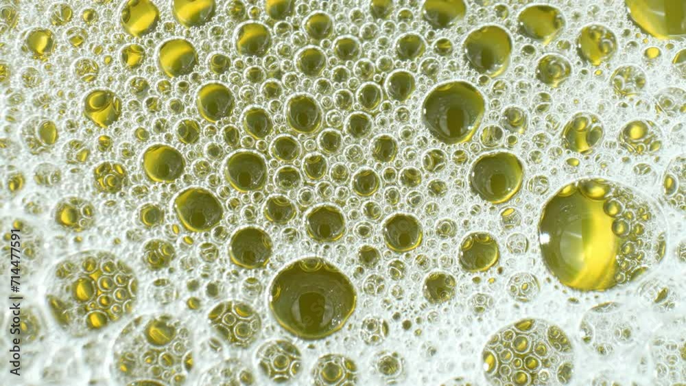 A macro video, foamy urine is observed due to protein molecules aggregating at the surface tension of the liquid. This phenomenon may signify renal issues. Body fluid concept. Stock footage. 4K HDR.
