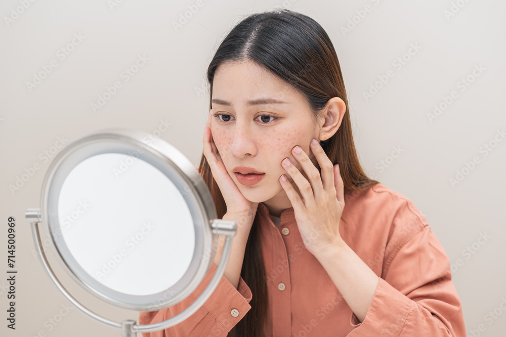 Dermatology, expression face worry asian young woman looking mirror hand touch face at dark spot of melasma, freckle from pigment melanin, allergy sun. Beauty care, skin problem treatment, acne care. Dermatology, expression face worry asian young woman looking mirror hand touch face at dark spot of melasma, freckle from pigment melanin, allergy sun. Beauty care, skin problem treatment, acne care.