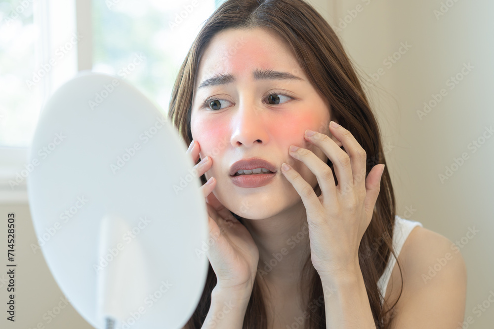 Dermatology, puberty asian young woman, girl looking at camera, allergy presenting an allergic reaction from cosmetic, red spot or rash on face. Beauty care from skin problem by medical treatment. Dermatology, puberty asian young woman, girl looking at camera, allergy presenting an allergic reaction from cosmetic, red spot or rash on face. Beauty care from skin problem by medical treatment.