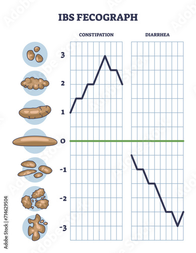 IBS fecograph as daily bristol stool form representation outline diagram, transparent background. Labeled educational scheme with constipation.