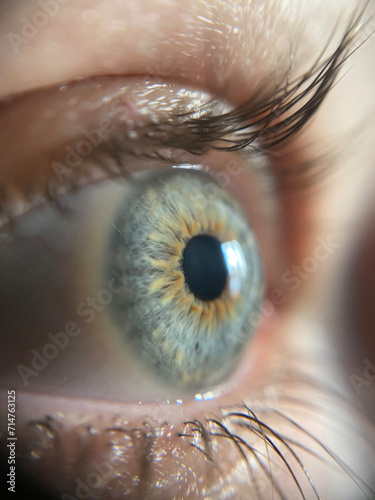 Untreated iris blue and orange eyes with long eyelashes.