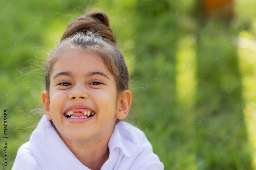 Portrait of a baby girl laughing, baby teeth fell out Portrait of a baby girl laughing, baby teeth fell out