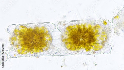 Marine diatom, Biddulphia sp. 2120x magnification. Live cell. Selective focus image