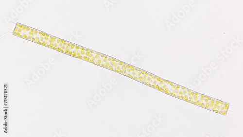 A freshwater diatom called Aulacoseira sp. 400x objective. Selective focus