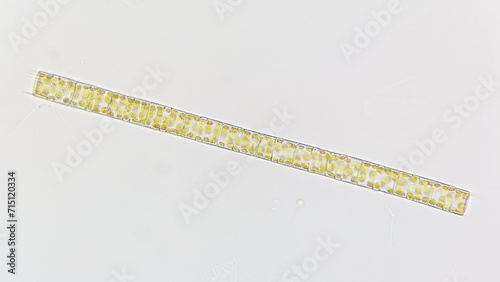 A freshwater diatom called Aulacoseira sp. 400x objective. Selective focus