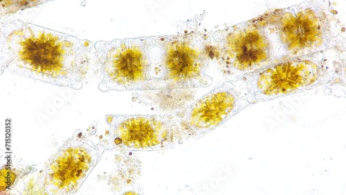 Marine diatom, Biddulphia sp. 920x magnification. Live cell. Selective focus image