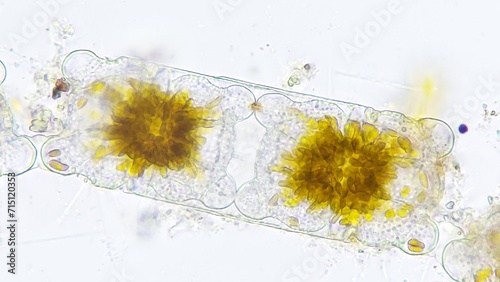 Marine diatom, Biddulphia sp. 2120x magnification. Live cell. Selective focus image