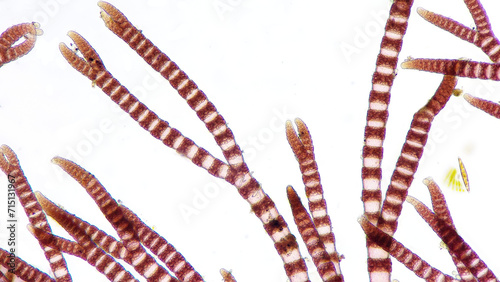 Ceramium sp, a marine macroalgae belonging to Rhodophyta. 210x magnification. Stacked photo