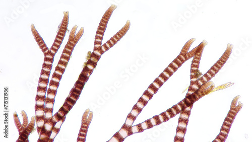 Ceramium sp, a marine macroalgae belonging to Rhodophyta. 210x magnification. Stacked photo photo