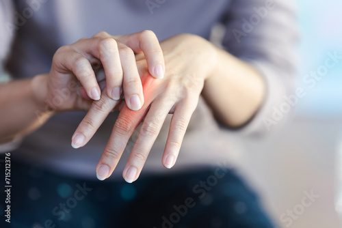 A woman touches a red area on her finger to indicate the pain point. photo