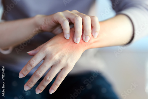A woman touches a red area on her wrist to indicate the pain point. photo