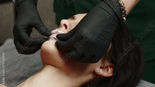 Cosmetology clinic, the doctor applies anesthesia to the patient's lips, anesthetic before injecting hyaluronic acid. Anesthetic ointment is applied before the injection procedure. photo
