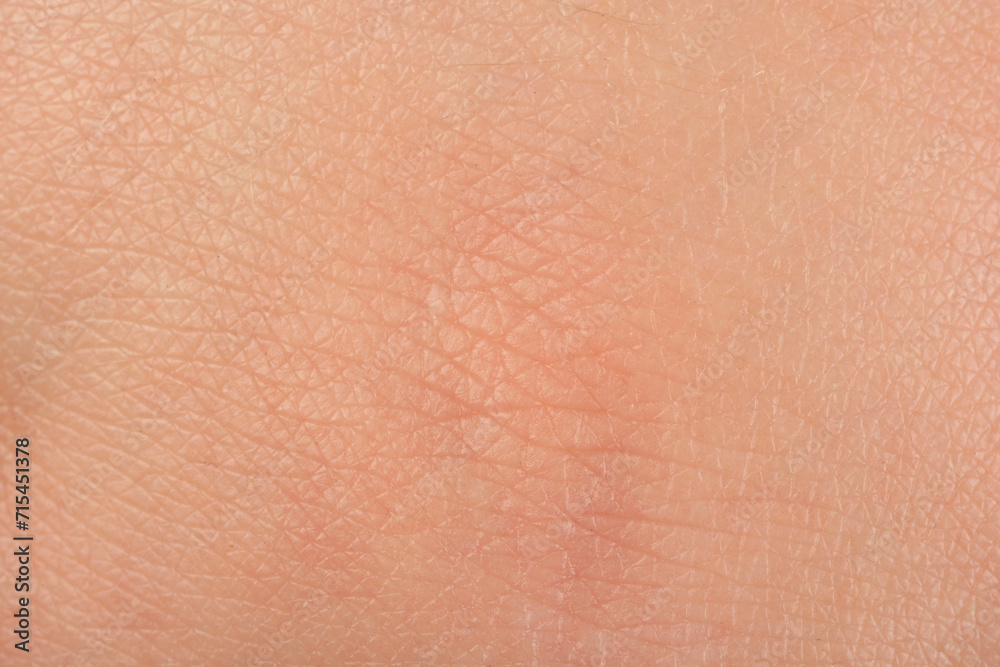 Texture of healthy skin as background, macro view Texture of healthy skin as background, macro view