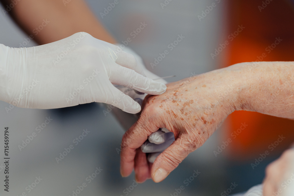 Close up of nurse insering IV cannula in vein, hand. Senior woman in intensive care unit in hospital. IV, intravenous therapy for elderly patient. Close up of nurse insering IV cannula in vein, hand. Senior woman in intensive care unit in hospital. IV, intravenous therapy for elderly patient.