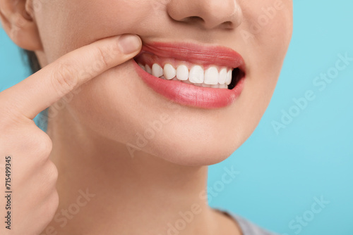 Woman showing her clean teeth on light blue background  closeup