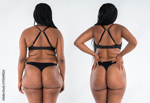 Female body before and after weight loss on gray background, African woman in black lingerie with fat hips and buttocks in slimming concept, plastic surgery
