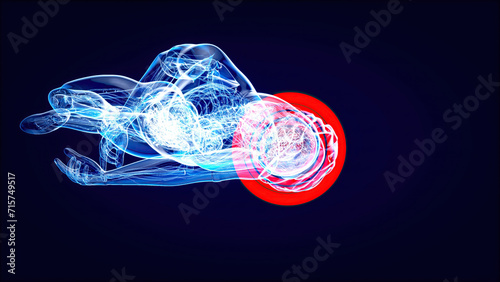 Abstract illustration of a Cyclist and a concussion photo