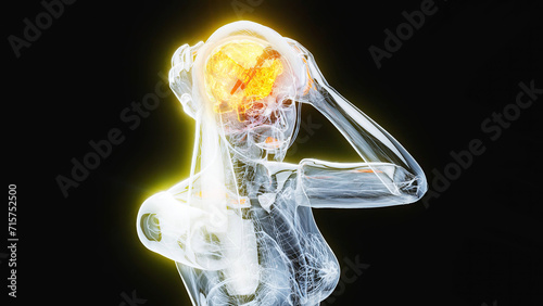 Abstract illustration of woman suffering from headache