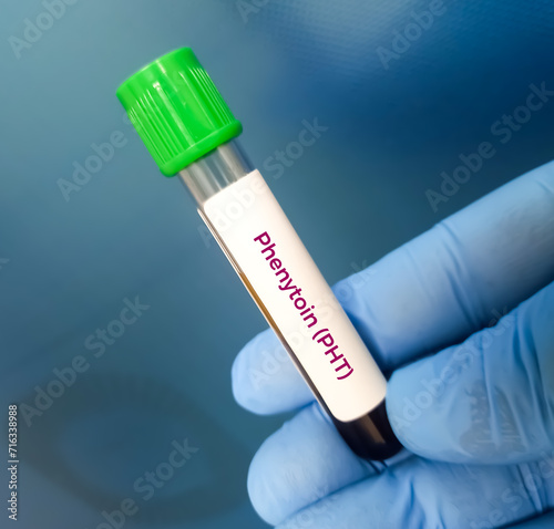 Blood sample for Phenytoin test, therapeutic drug, to maintain a therapeutic level and diagnose potential for toxicity. photo