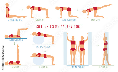 Woman doing exercises for kyphotic lordotic posture rehabilitation. Educational instructions for physiotherapist, stretching and strengthening muscles in flat design.