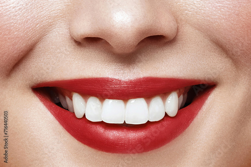 Perfect smile. Oral care concept. Close up portrait of a woman with healthy tooth and red lips make up is smiling