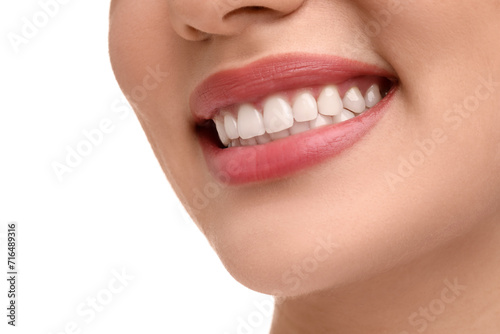 Woman with clean teeth smiling on white background, closeup