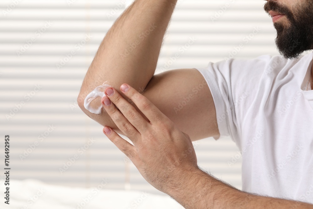 Man with dry skin applying cream onto his elbow on light background, closeup