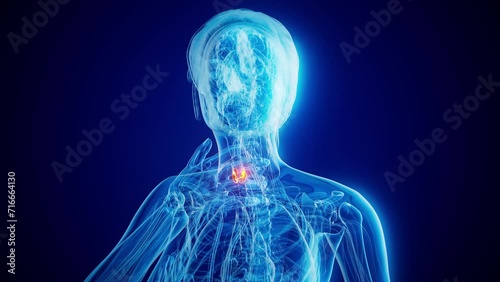 Abstract animation of a woman and the thyroid gland photo