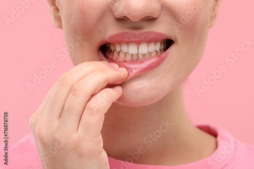 Beautiful woman showing her clean teeth on pink background, closeup