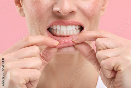Woman showing her clean teeth on pink background  closeup