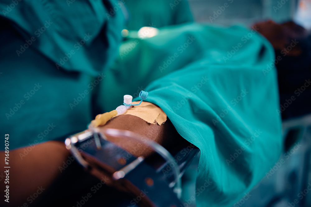 Close up of surgical patient in operating room. Close up of surgical patient in operating room.