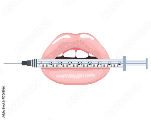 Lips holding a syringe. Beauty concept of lips, lip filler. Medical icon, cosmetology logo. Illustration, vector