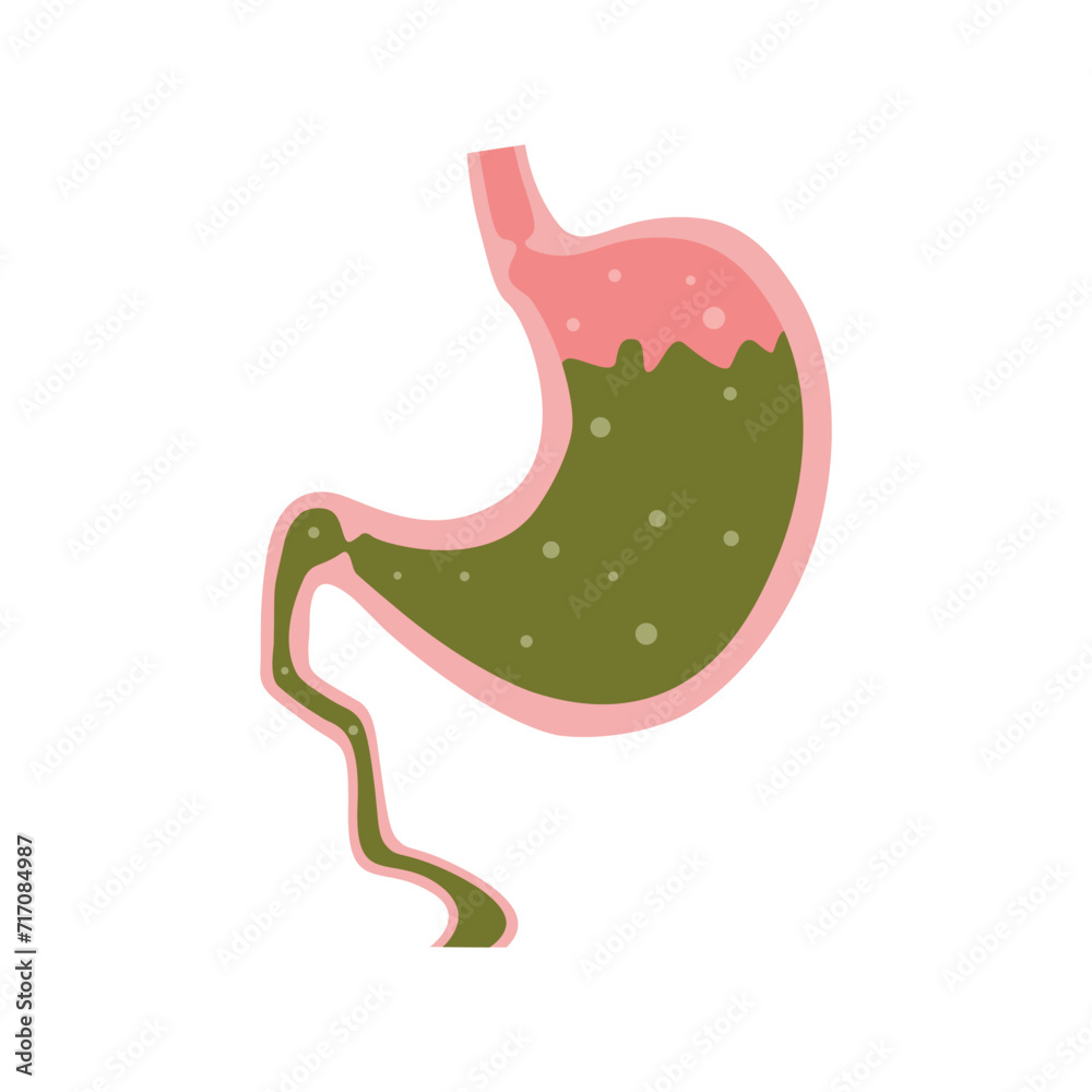 Stomach with juice, food in cartoon flat style isolated on white background. Anatomy of normal healthy stomach after eating. Anatomy structure of the organ, esophageal and duodenal sphincter. Stomach with juice, food in cartoon flat style isolated on white background. Anatomy of normal healthy stomach after eating. Anatomy structure of the organ, esophageal and duodenal sphincter.