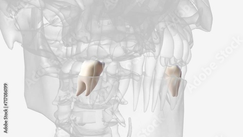 The mandibular first molar usually has two roots, a mesial and a distal . photo