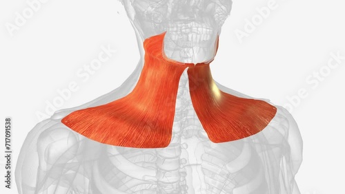 The platysma muscle is a superficial muscle of the human neck that overlaps the sternocleidomastoid .