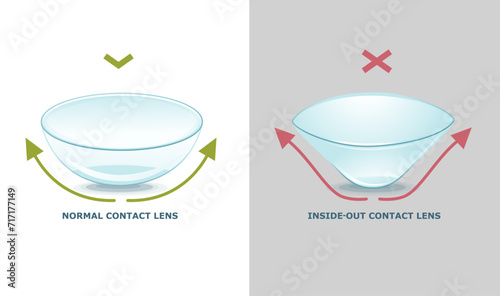 Normal contact lens, inside-out contact lens. How to check the lenses. Infographic. Healthcare illustration. Vector illustration. 