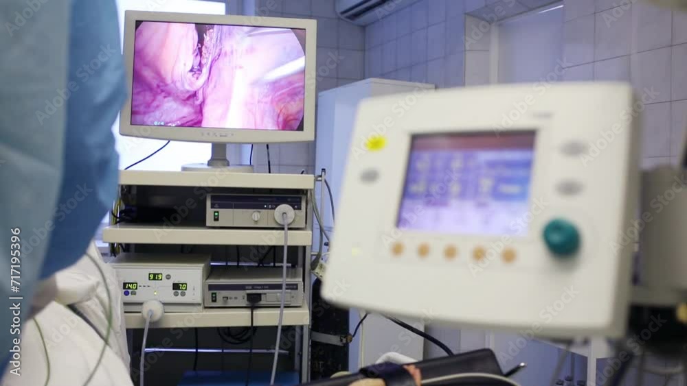 Display showing endoscopic surgery in abdominal organ Display showing endoscopic surgery in abdominal organ