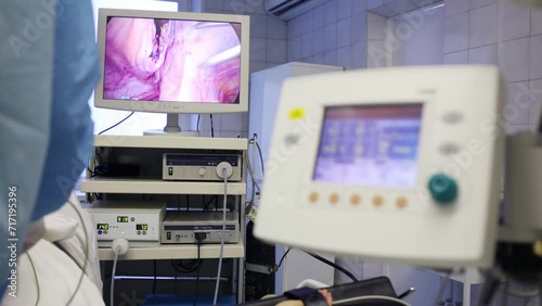 Wallpaper Mural Display showing endoscopic surgery in abdominal organ  Torontodigital.ca