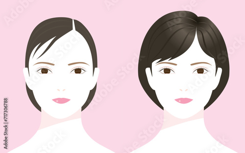 シニア女性のヘアスタイル。薄毛とボリュームのある髪の毛...