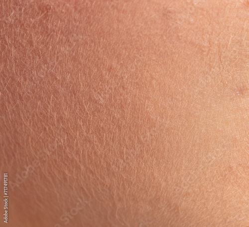 Human skin as an abstract background. Texture