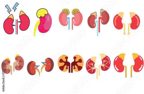 addison’s disease,Adrenal Disorder of Addison’s or Cushing’s syndrome Adrenocortical carcinoma gene mutation with Corticosteroid,kidney,Addison's disease color line icon set.,ten