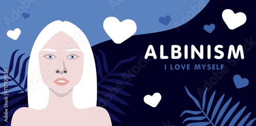 Banner about albinism with young woman with European appearance minimalistic illustration photo