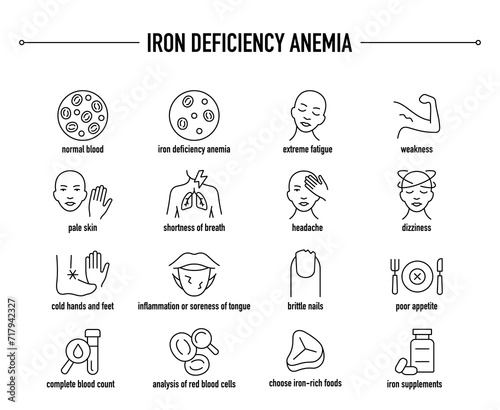 Iron Deficiency Anemia symptoms, diagnostic and treatment vector icons. Line editable medical icons.