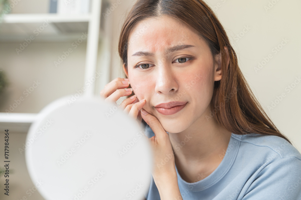 Sensitive skin with cosmetology, Asian young woman looking at red spot on her face from cosmetic allergy in the mirror. Sensitive skin with cosmetology, Asian young woman looking at red spot on her face from cosmetic allergy in the mirror.