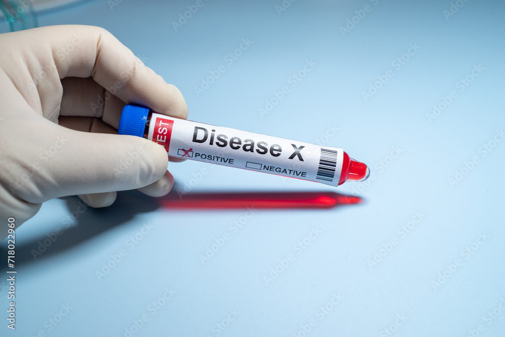 Obraz premium Background of Disease X.Disease X is an unknown pathogen that could cause a serious international epidemic.Medical health concept.