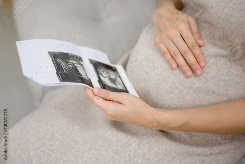 A pregnant woman sits in the living room at home looking at an ultrasound image of her baby. Happy pregnancy woman during prenatal ultrasound at her home