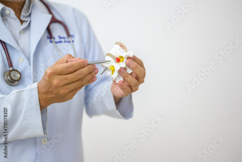 An orthopedic surgeon holds a spinal model as he demonstrates treatment methods for human spinal injuries caused by back pain during a medical consultation