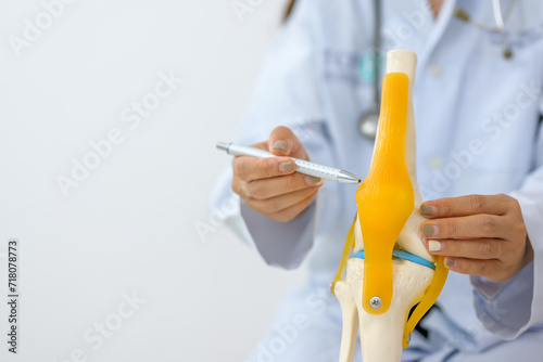 Close-up of therapist or orthopedic surgeon showing knee joint model during medical consultation and demonstrating treatment of human cruciate ligament injury photo