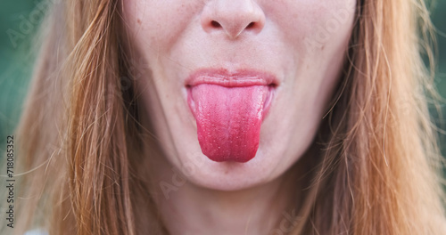 Stick out your pink tongue. Woman shows her drink-stained tongue. Close-up, front view, face, unrecognizable.